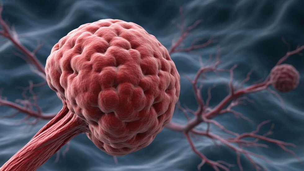 علماء روس يبتكرون مادة نانوية لعلاج السرطان والعدوى البكتيرية